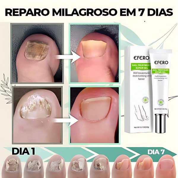 Efero Nails - Removedor de Fungos/Micoses + Fortalecimento das Unhas |COMPRE 2 LEVE 3| Frete Grátis