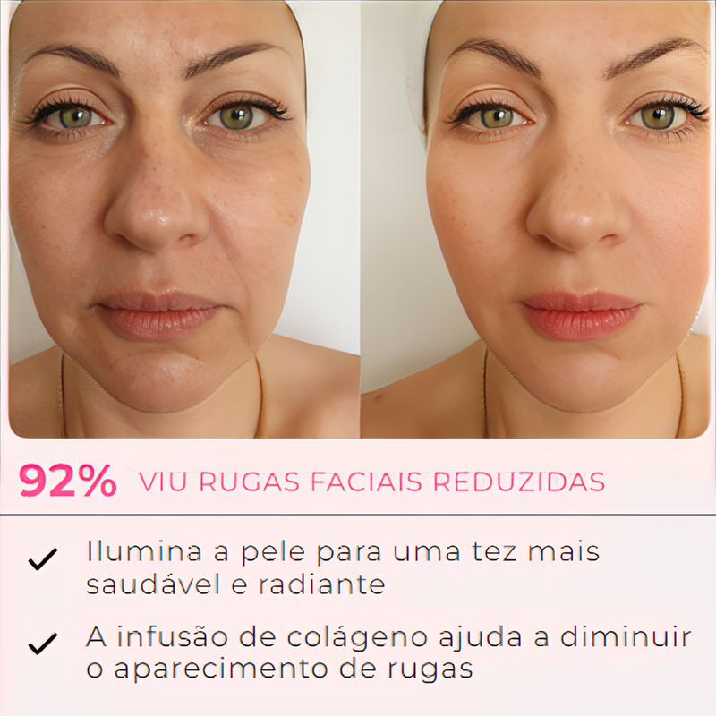 MaskLifting - Retire Imperfeições Faciais | PROMOÇÃO ESPECIAL | TRATAMENTO COMPLETO + Frete Grátis (cópia)