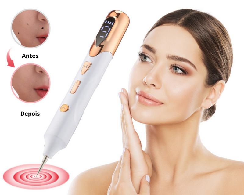 CleanLaser - Kit Profissional Caneta de Plasma + Brinde