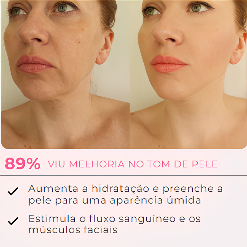 MaskLifting - Retire Imperfeições Faciais | PROMOÇÃO ESPECIAL | TRATAMENTO COMPLETO + Frete Grátis (cópia)