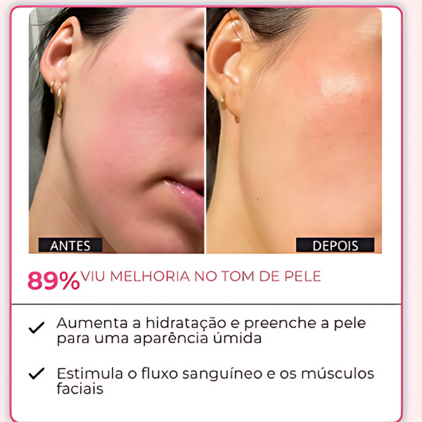 7 AMPOLAS -  Retire IMPERFEIÇÕES *EFEITO BOTOX* | Frete Grátis
