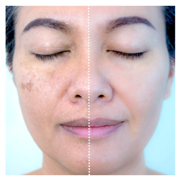 Sérum Celestial: Ação Clareadora e Antirrugas - Retire Imperfeições Faciais | COMPRE 1 LEVE 2 | Frete Grátis