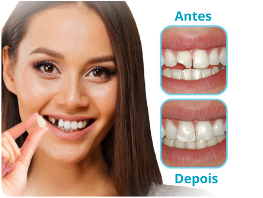 Restaurador Dental Smile®: O Caminho Para o Seu Sorriso Perfeito!