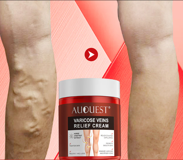 VarizSkin™ 3D - Removedor de Varizes 6 Em 1