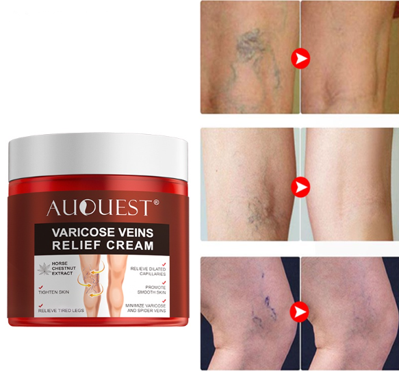 VarizSkin™ 3D - Removedor de Varizes 6 Em 1