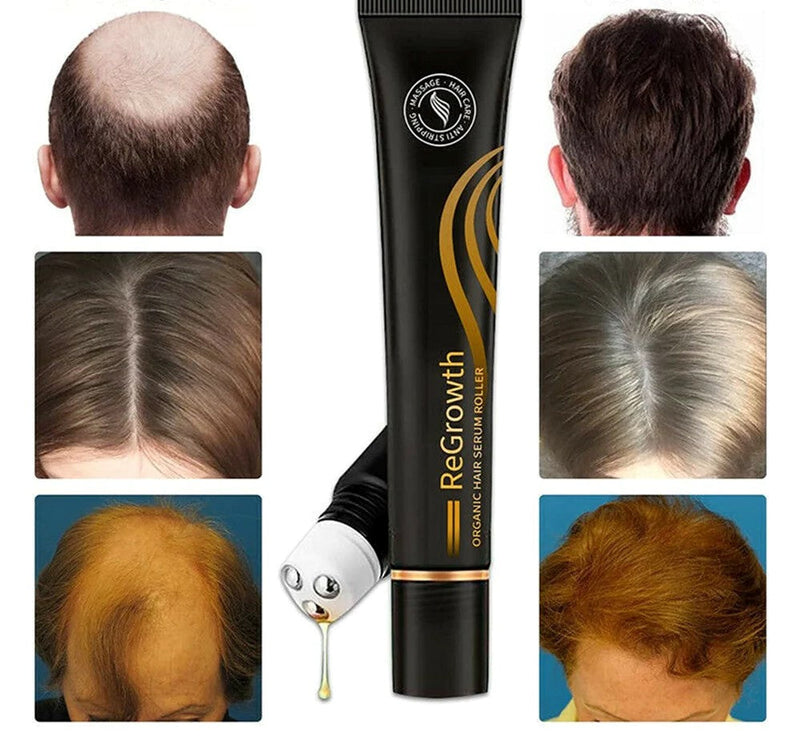 HairUp - Diminui Queda em 95%